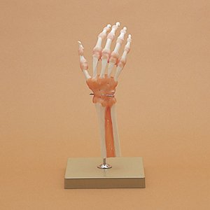手関節模型
